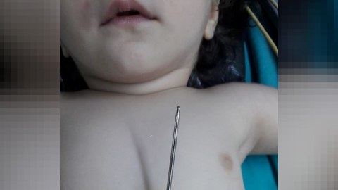 Bakıda 1 yaşlı uşağın qarnına mil batdı - FOTO   