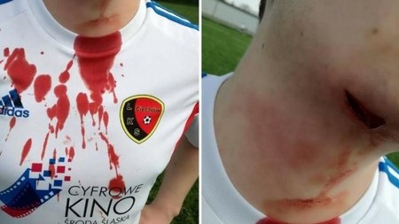 Azarkeşlər futbolçunun boğazını kəsdilər
