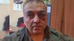 Ermənistanda banka hücum edən polis polkovniki çıxdı - VİDEO