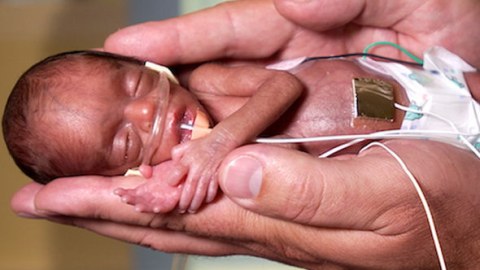 Abortlar və onların fəsadları - Azərbaycan və dünya üzrə STATİSTİKA