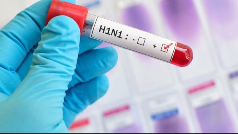 Baş epidemioloq Azərbaycanda 16 nəfərin A/H1N1 virusuna yoluxduğunu TƏSDİQLƏDİ