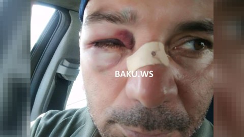 Bakıda jurnalisti döyən şəxs SAXLANILDI