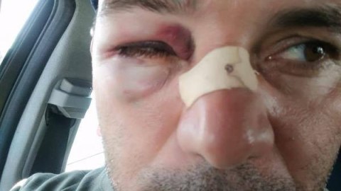Döyülən jurnalistə rüşvət təklif olundu: “Müstəntiq bunu nəzərə almır”  