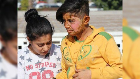 Gənc qızı yandırıb bu hala saldılar - FOTO