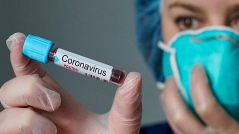Azərbaycanda daha 4 nəfər koronavirusa YOLUXDU  