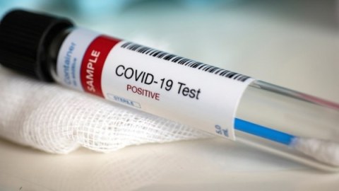 Azərbaycanda icra başçısının müavini koronavirusa yoluxdu
