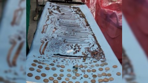 Hindistanda gənc qadının mədəsindən 2 kilo qızıl sikkə çıxarıldı