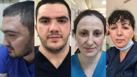 Bu günümüzün qəhrəmanları: virusla mübarizə aparan TİBB İŞÇİLƏRİ - FOTO
