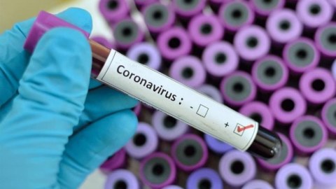 Türkiyədəki vətəndaşlarımız pulsuz koronavirus testindən KEÇƏCƏKLƏR
