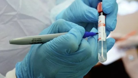 Pakistanda koronavirusa yoluxanların sayı 246 mini ötüb