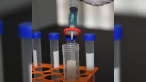 Koronavirus əleyhinə zərdab ixtira edildi