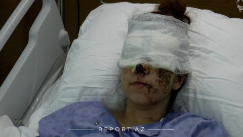 Ermənilərin Gəncə terroru iki uşaq anasını görmə qabiliyyətindən məhrum etdi