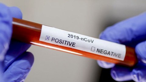 Evini tərk edən 29 koronavirus xəstəsi SAXLANILIB