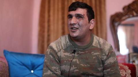 Cəsur döyüşçülər - Hər iki gözünü itirən əsgər: “Azacıq ümid var, mənə kömək göstərilsin” - FOTOLAR