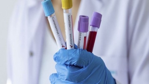 Rusiyada koronavirusa yoluxanların sayı açıqlandı