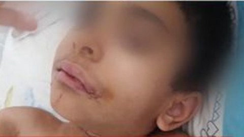 Daxili işlər naziri və Baş prokuror 5 yaşlı uşağın işini nəzarətə götürdü