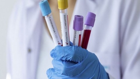 Rusiyada koronavirusdan ölənlərin yeni sayı açıqlandı
