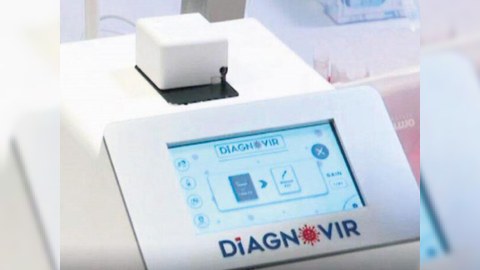 Bu cihaz koronavirusu 10 saniyəyə aşkar edir 