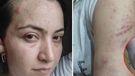 Polis şöbəsində qətlə yetirilən qadının qardaşı DANIŞDI