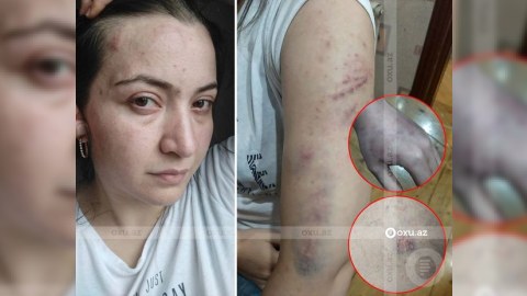Öldürülən qadının uşaqları qəyyumluğa verildi - RƏSMİ