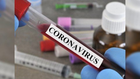 Rusiyada koronavirus mənzərəsi