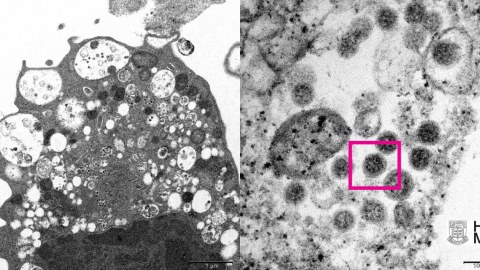 “Omicron”un ilk fotosu yayıldı