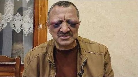 Tofiq Yaqublunun döyülməsi ilə bağlı araşdırma YEKUNLAŞDI