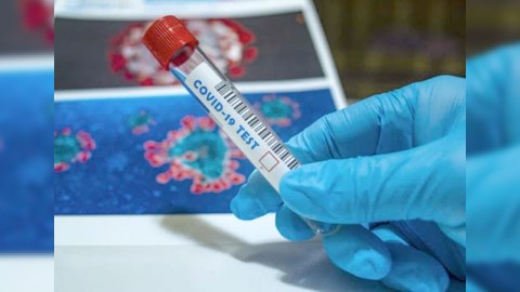 Rusiyada virusa yoluxma sayı 11 milyonu ötüb 