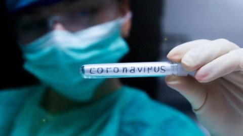 Ermənistanda daha 3536 nəfərdə virus aşkarlandı