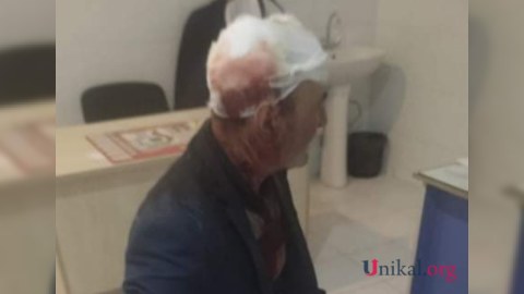 Gəncədə yaşlı kişini baltaladılar