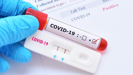 COVID testlərini Azərbaycana bu şirkət gətirəcək