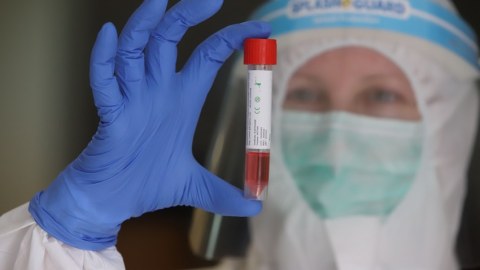 Bir ayda eyni ştama təkrar yoluxma mümkündürmü?