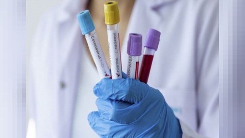 Rusiyada yoluxma sayı 14 milyonu ötdü