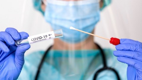 Cüdoçularımızda koronavirus aşkarlandı