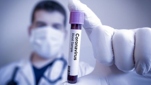 Rusiyanın koronavirus statistikası