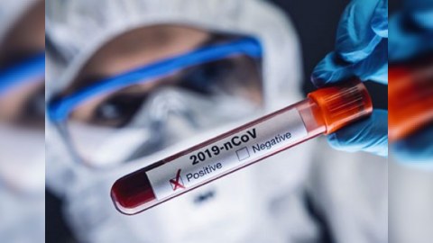 Dünyanın koronavirus mənzərəsi