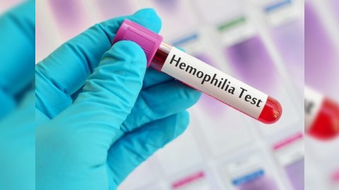 Hemofiliyalı xəstələrin sayı AÇIQLANIB