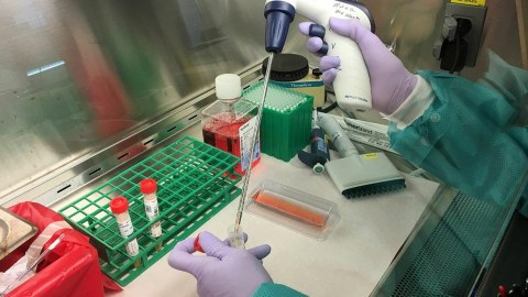 Uşaqlar arasında naməlum hepatit yayılır