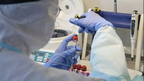 ÜST mənşəyi məlum olmayan virusu ARAŞDIRIR
