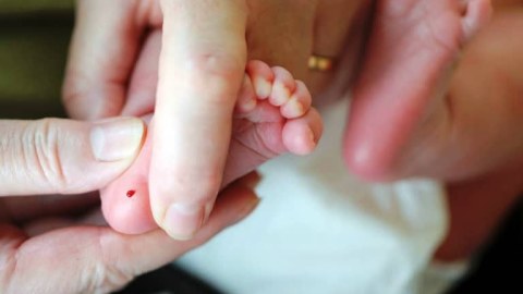 Azərbaycanda körpələrdən topuq testi götürülür