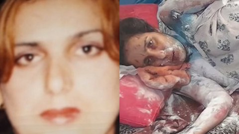 Qayınatasının üzünə "kislota" tökdüyü deyilən gəlin öldü - VİDEO