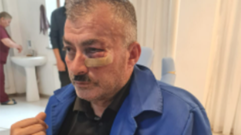 Borclu abonent “Azəriqaz”ın əməkdaşını döydü - FOTO