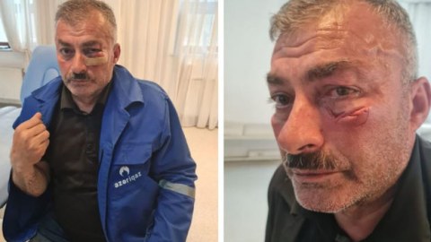 “Azəriqaz”ın əməkdaşını döyən şəxsə cinayət işi AÇILDI