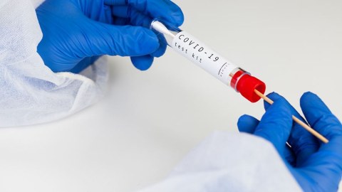 Xəstəxanalarda COVID testi tələbi ləğv olundu