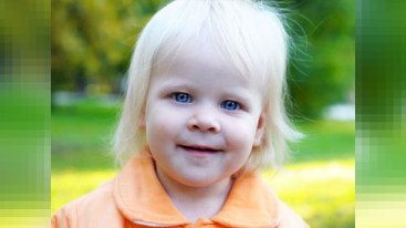 Azərbaycanda neçə albinos var?