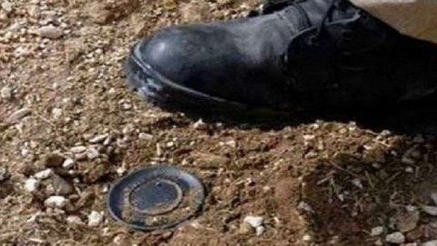 Minaya düşən polisin ayağı amputasiya edildi