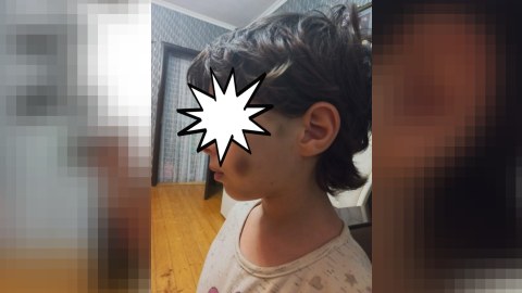 3 bacı anasının sevgilisi tərəfindən döyülüb - FOTOLAR
