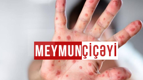 Meymunçiçəyinə görə fövqəladə vəziyyət elan olundu