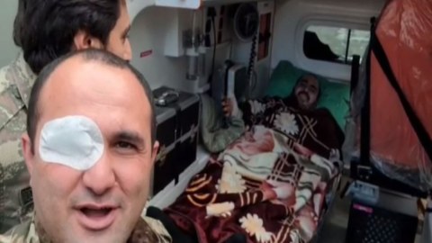 Özünü yandıran qazi xəstəxanadan evə buraxıldı 