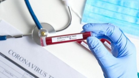 Dünyanın koronavirus MƏNZƏRƏSİ: milyonlarla insan...